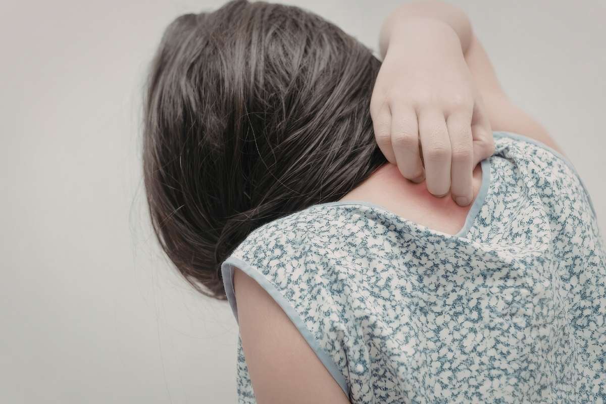 Especialista en irritación en la piel en CDMX